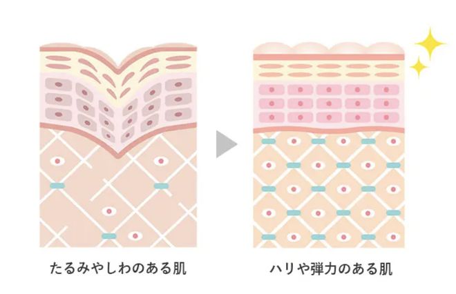 植物干细胞培养液让肌肤焕颜重生的钥匙(图3)