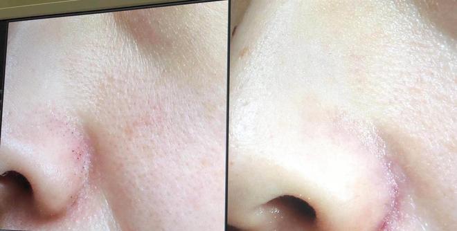 口碑好的眼部护理机构