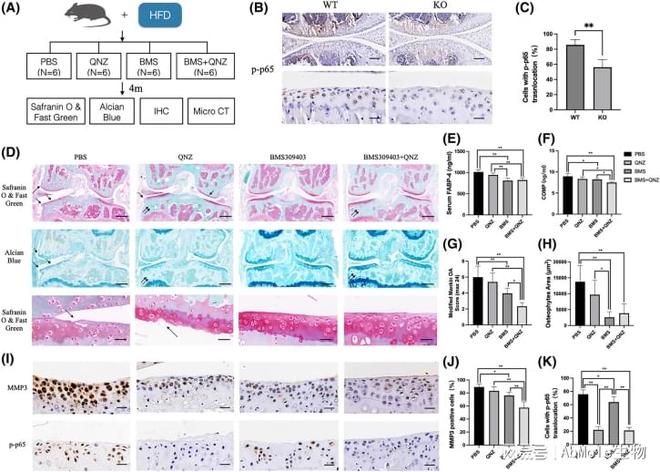 AbMole丨NF-κB通路的高引用抑制剂及其在肿瘤和炎症研究中的应用(图4)